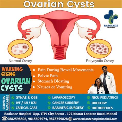 biopsy ovarian cyst|ovarian cyst warning signs.